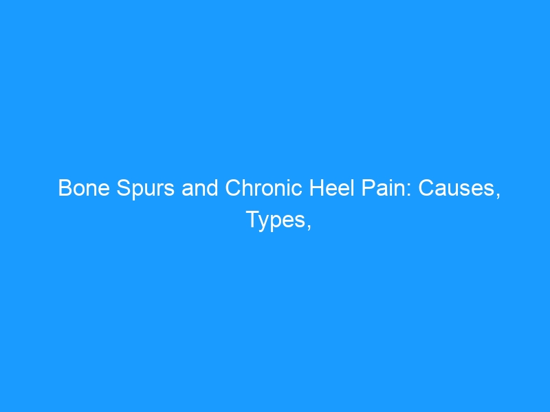 Bone Spurs and Chronic Heel Pain: Causes, Types, Treatment, and the Best Shoes — 2026 Complete Guide