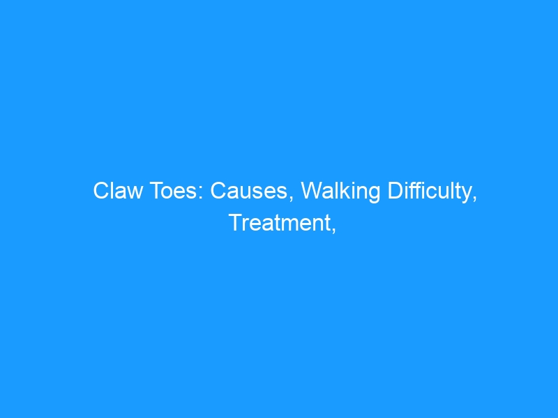 Claw Toes: Causes, Walking Difficulty, Treatment, and the Right Shoes — 2026 Complete Guide