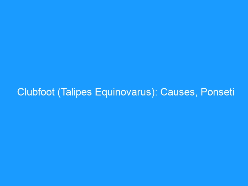 Clubfoot (Talipes Equinovarus): Causes, Ponseti Treatment, Mobility, and Lifelong Footwear — 2026 Complete Guide