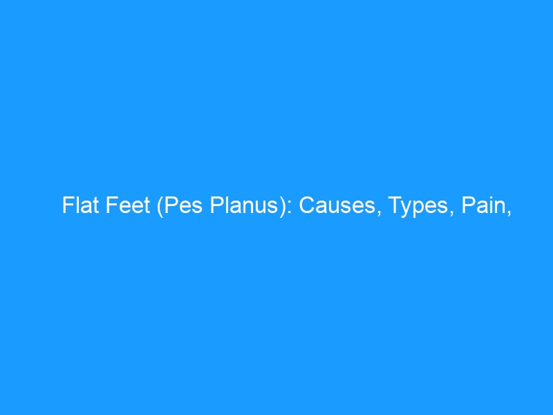 Flat Feet (Pes Planus): Causes, Types, Pain, Treatment, and the Best Shoes — 2026 Complete Guide