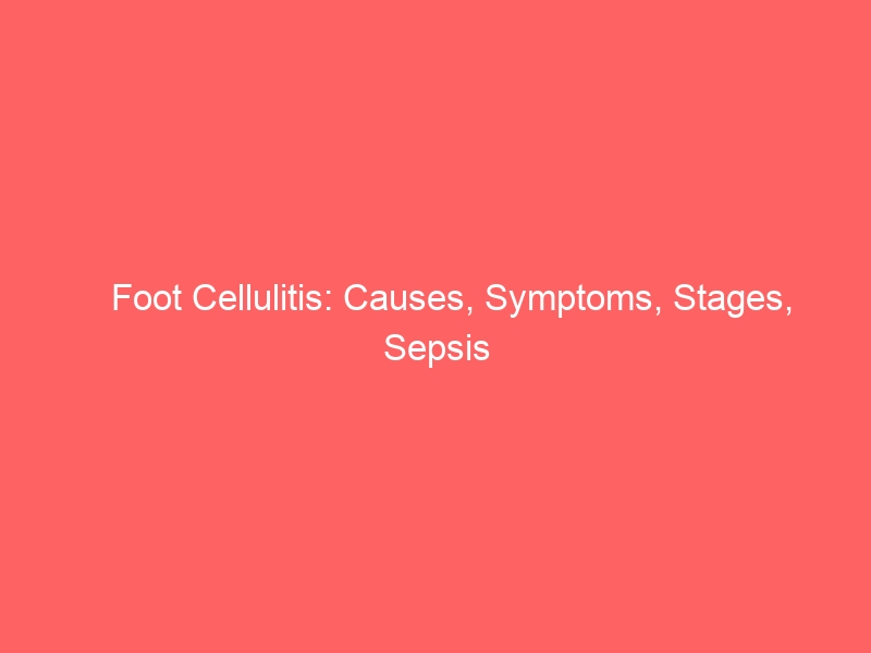 Foot Cellulitis: Causes, Symptoms, Stages, Sepsis Risk, and When to Go to Hospital — 2026 Complete Guide