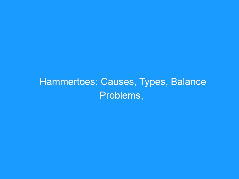 Hammertoes: Causes, Types, Balance Problems, Pressure Sores, Treatment, and Prevention — 2026 Complete Guide