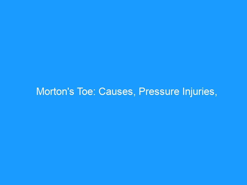 Morton’s Toe: Causes, Pressure Injuries, Calluses, and the Shoes That Actually Help — 2026 Complete Guide