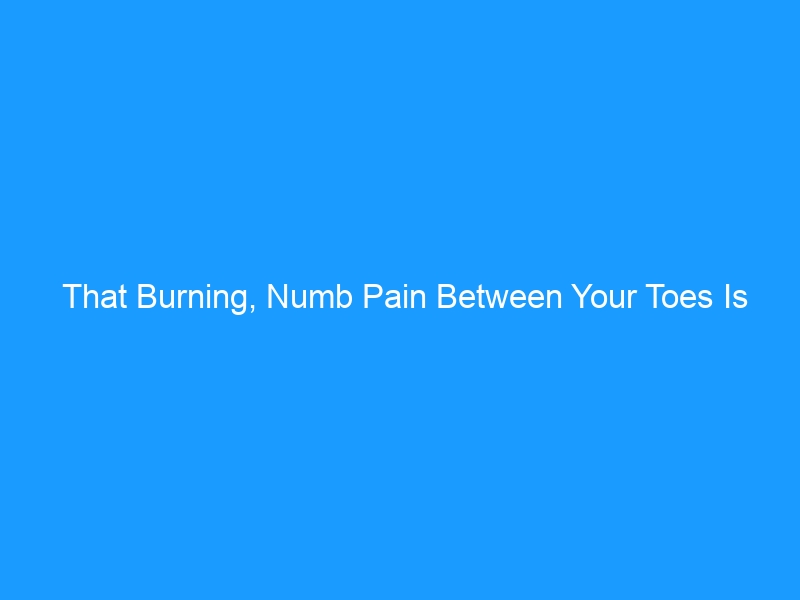 That Burning, Numb Pain Between Your Toes Is Probably Morton’s Neuroma — The Complete 2026 Guide to Causes, Diagnosis, Treatment & the Best Shoes for Relief