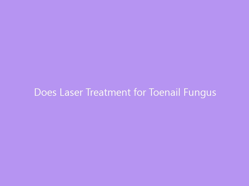 Does Laser Treatment for Toenail Fungus Actually Work? A Complete 2026 Guide to Efficacy, Cost, and What to Expect