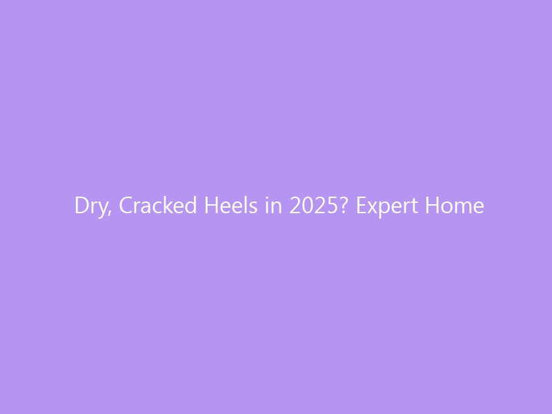 Dry, Cracked Heels in 2025? Expert Home Remedies That Actually Work — Causes, Treatment Protocols & the Best Shoes for Recovery