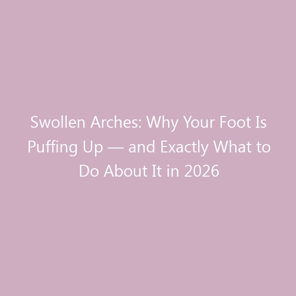 Swollen Arches: Why Your Foot Is Puffing Up — and Exactly What to Do About It in 2026