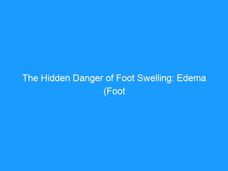 The Hidden Danger of Foot Swelling: Edema (Foot Swelling) & Skin Breakdown — Causes, Prevention & Best Footwear for 2026